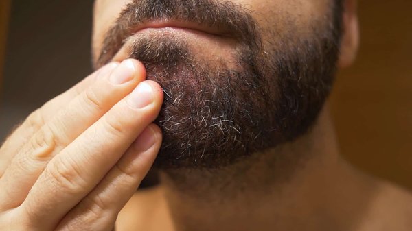 Éviter les Pellicules de Barbe: Méthodes Efficaces